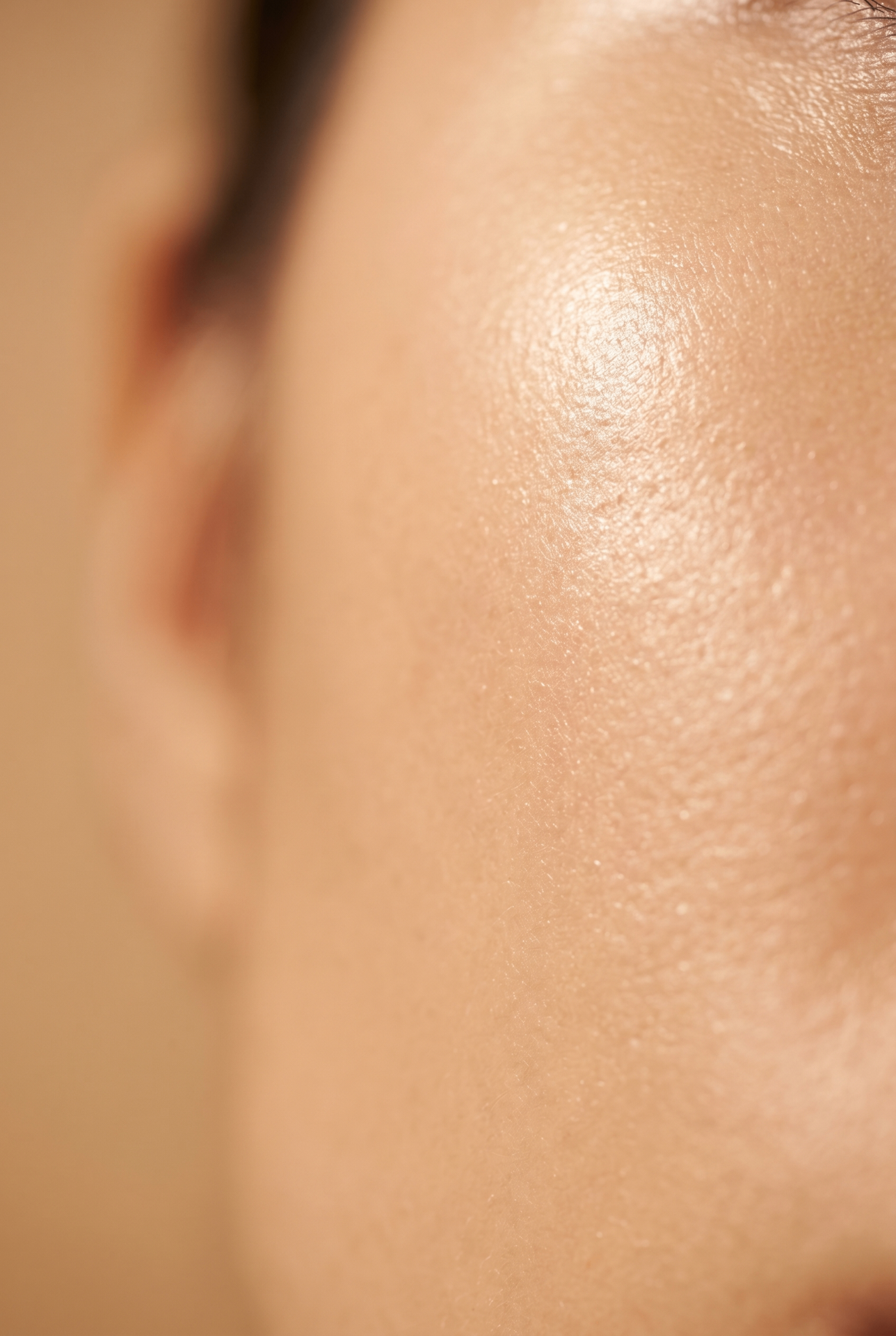 Acne littekens foto 2